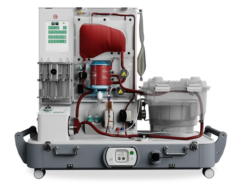 OrganOx transplant perfusion technology